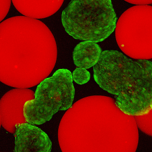 <p>Islets (stained green with viability stain) mixed with microgels presenting FasL (red).</p> Islets (stained green with viability stain) mixed with microgels presenting FasL (red).